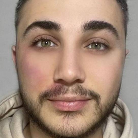 JONNY DAWI